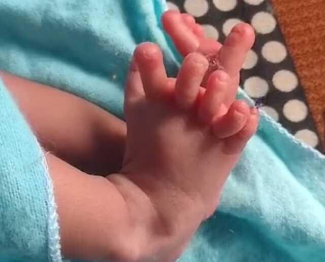 Hindistan'da Bharatpur şehrinde 26 parmakla dünyaya gelen bebek tanrıça olarak görülüyor