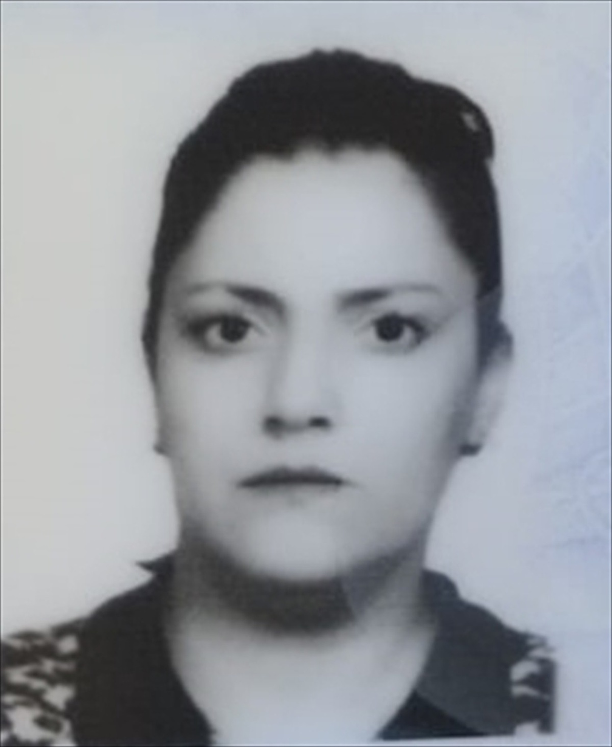 Çorum\'da boşandığı eşi tarafından bıçaklanan kadın ağır yaralandı