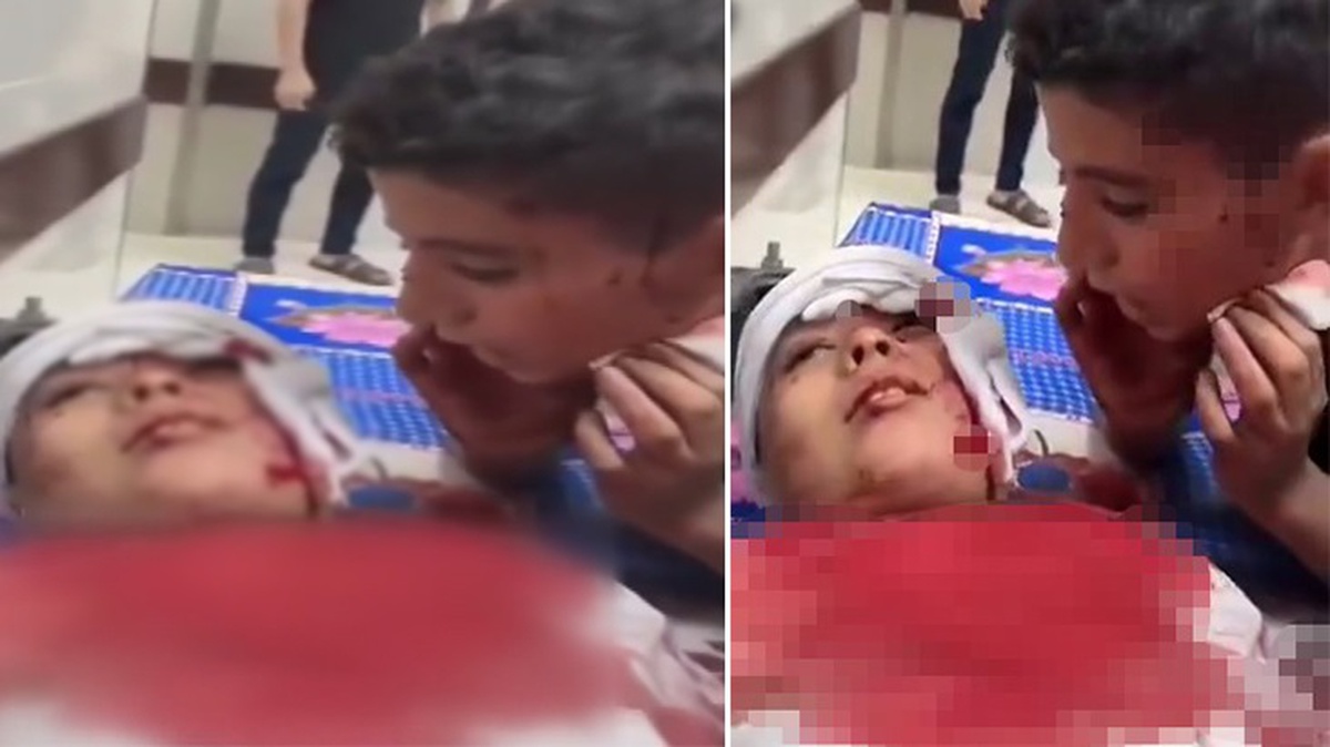 Filistinli çocuk, İsrail saldırısında yaralanan kardeşine kelime-i şehadet getirtti