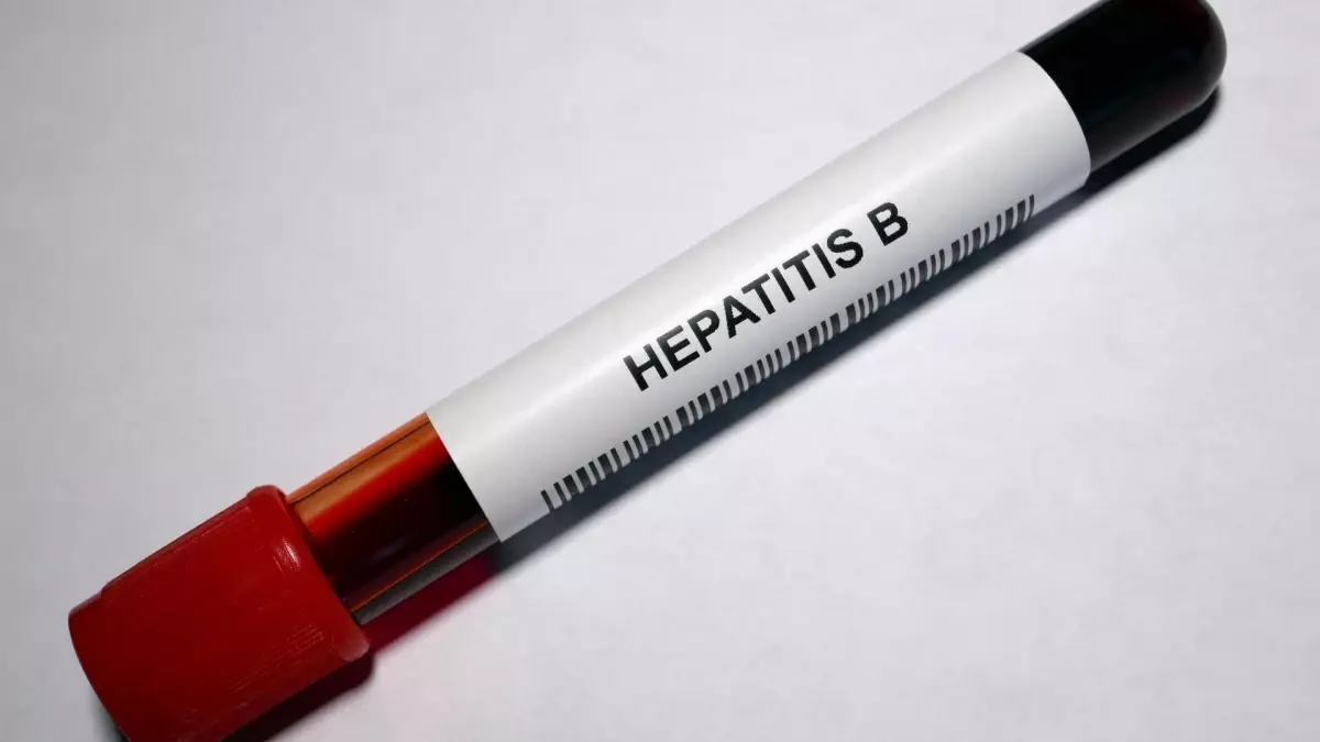 Hepatit b nedir, belirtileri neler? Hepatit b nasıl geçer?