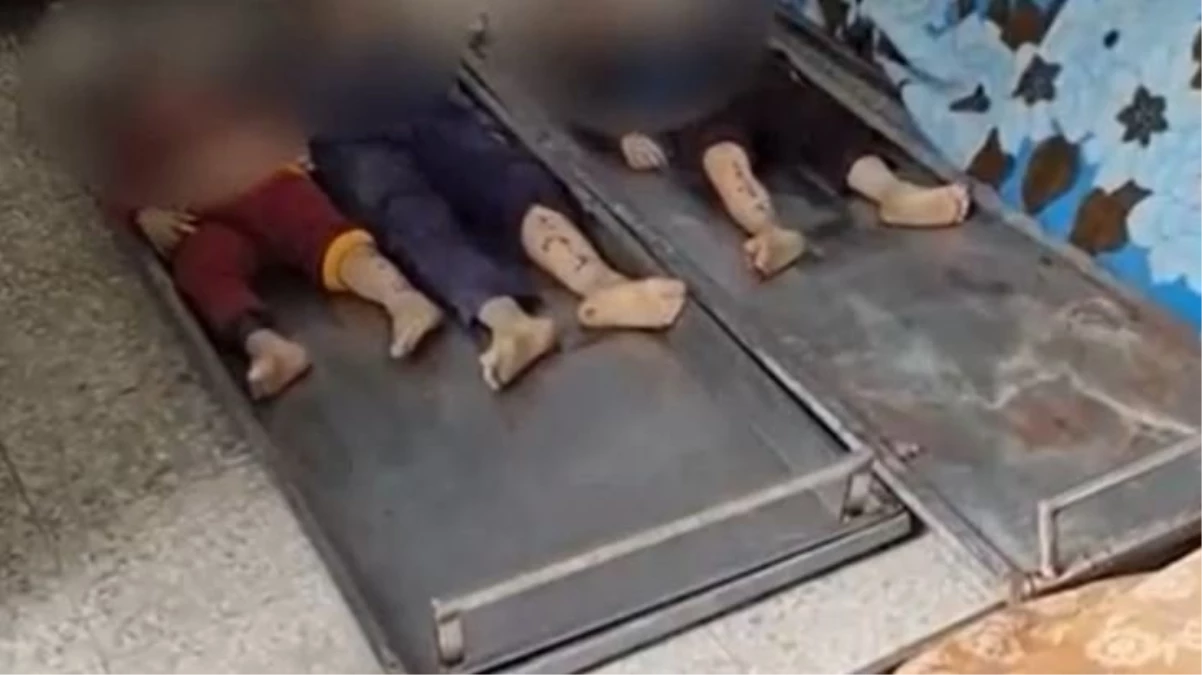 İsrail bombardımanında öldürülen çocukların bacaklarındaki detay kahretti