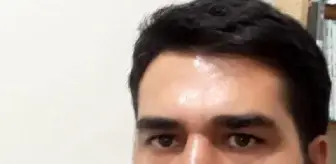 Ankara'da Hemşire Kardeşini Öldürdü, Başını Gövdesinden Ayırdı
