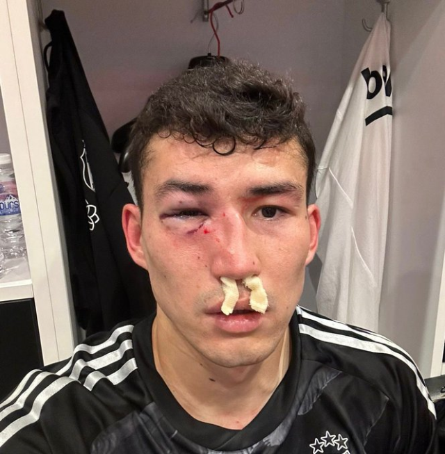 Birisi sadece 4 dakika oyunda kaldı! Beşiktaş'ta 2 yıldız futbolcu sakatlandı