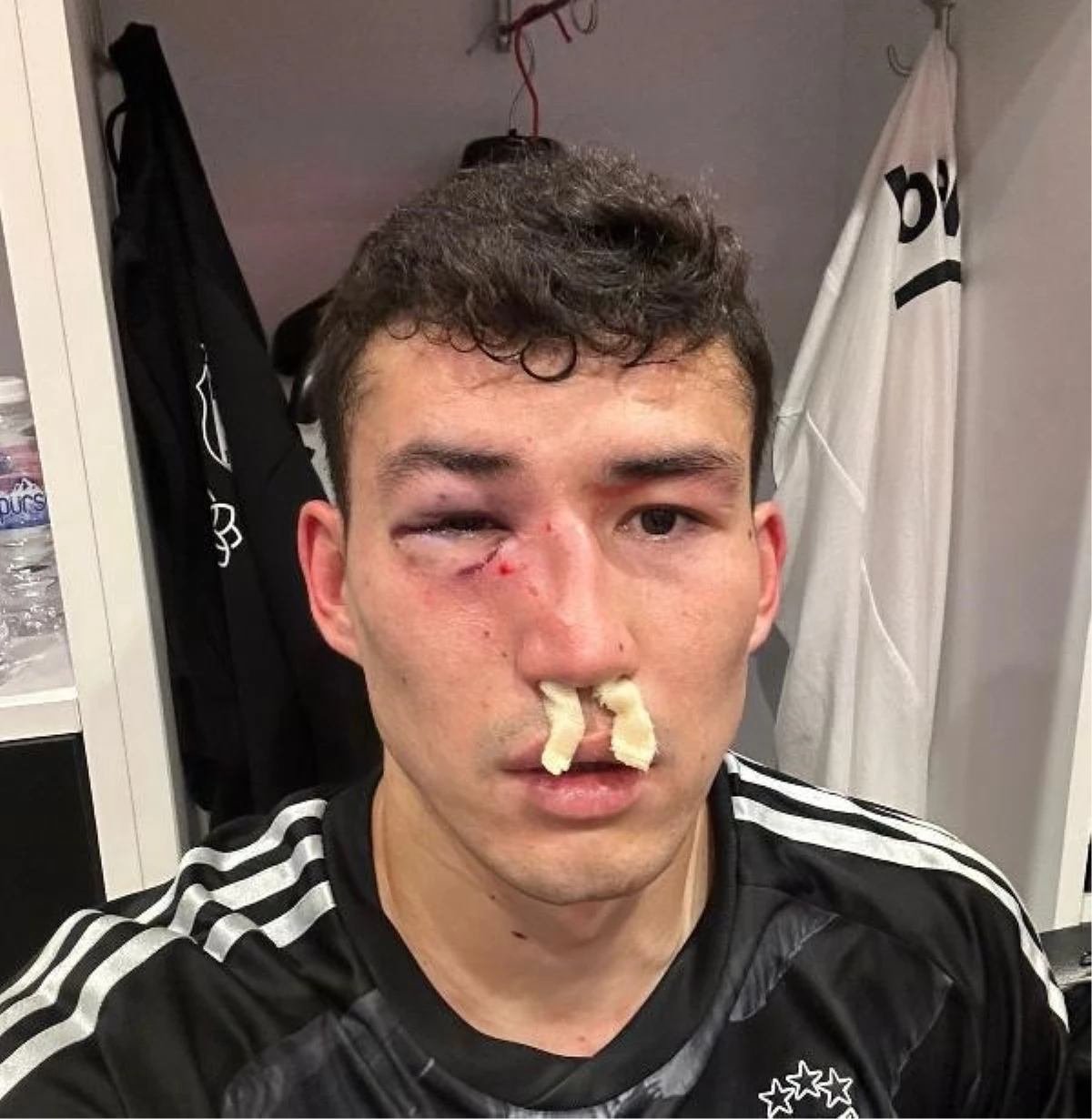 Beşiktaşlı Zaynutdinov, Başakşehir maçında sakatlandı