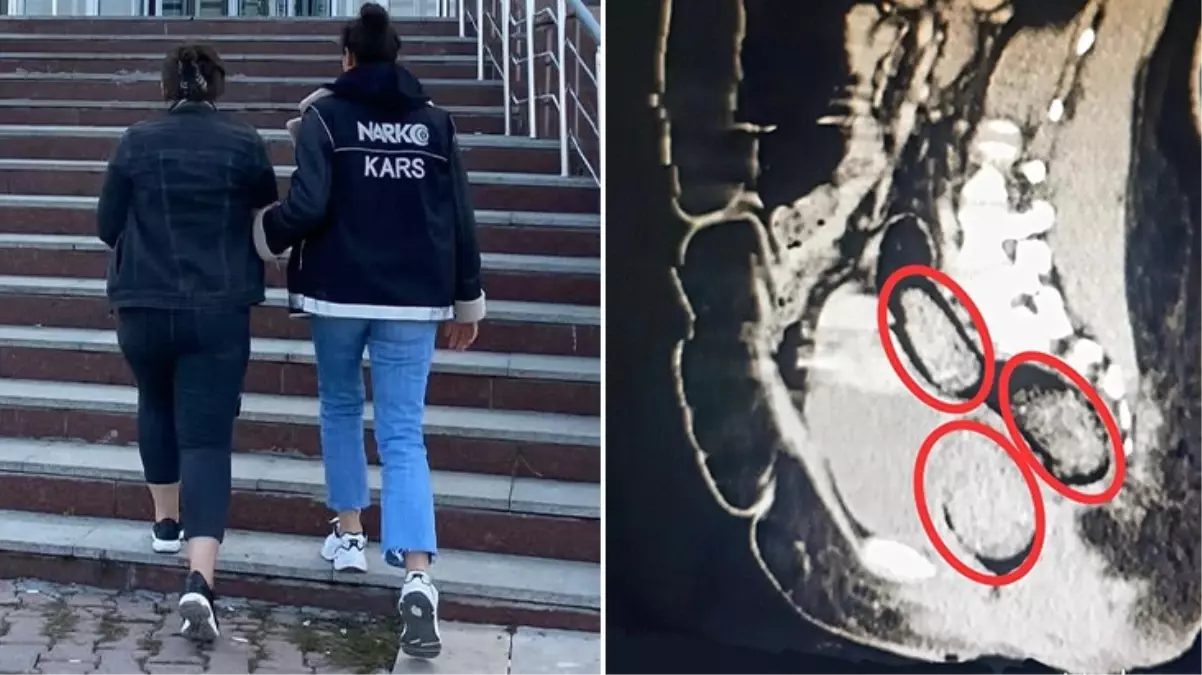 Kars\'ta otobüste yakalanan İran uyruklu kadının makatından uyuşturucu çıktı