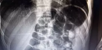 Erzurum'da Yolcu Otobüsünde Afyon Sakızı Bulundu