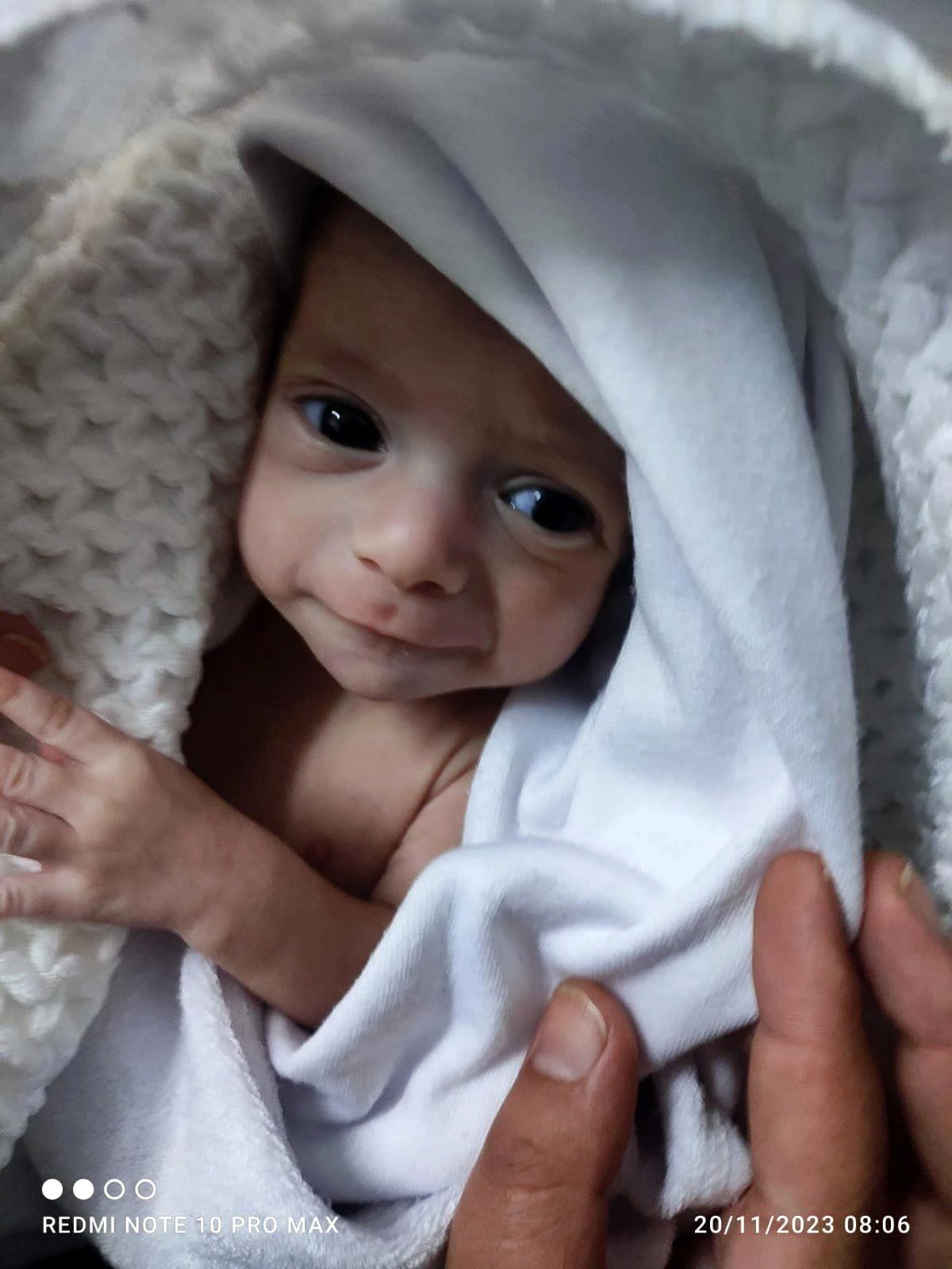 Gazzeli anne ve babalar prematüre bebekleriyle buluştu: \'Hala yaşıyor olmaları bir mucize\'