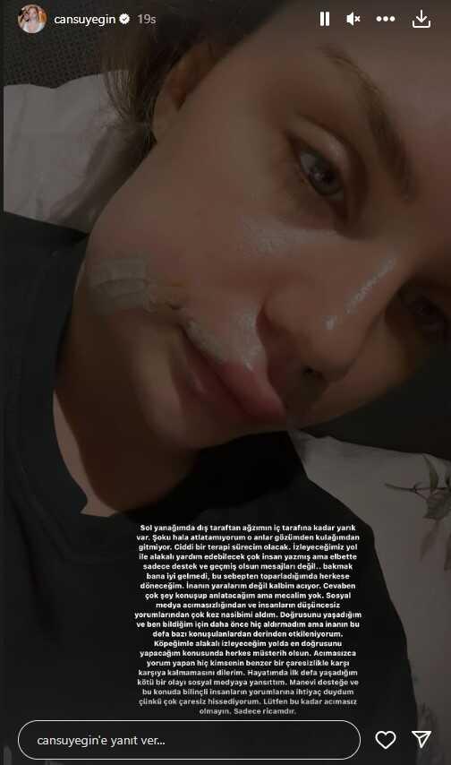 Sosyal Medya Fenomeni Cansu Yeğin, köpeğinin saldırısına uğradı