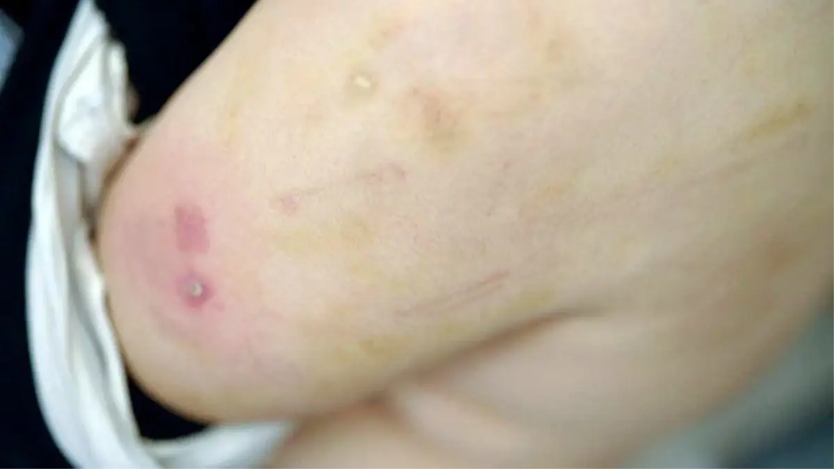 İsrail\'in serbest bıraktığı Filistinli mahkumlar, işkence gördüklerini söylüyor