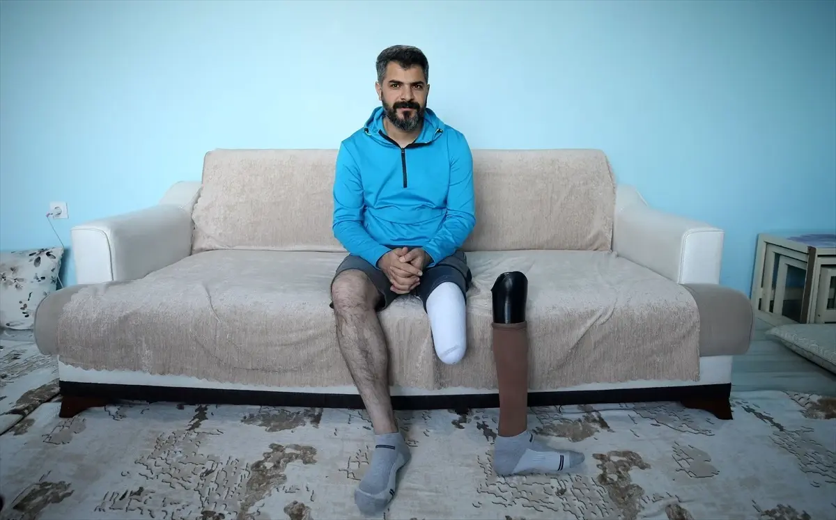 Elektrik Akımına Kapılan ve Ayağı Kesilen Engelli Sporcu Kamuran Bartan