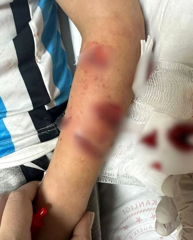 Rize'de 12 yaşındaki çocuk köpek saldırısına uğradı