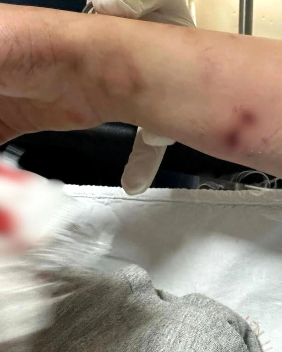 Rize\'de başıboş sokak köpeği 12 yaşındaki çocuğa saldırdı