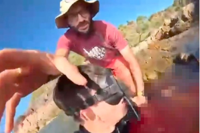 Avustralyalı genç, köpek balığının videosunun çektiği sırada balık bacağını kopardı