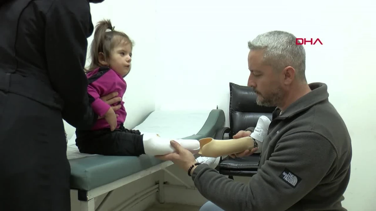 3,5 yaşındaki Tali, protez bacaklarına kavuştu