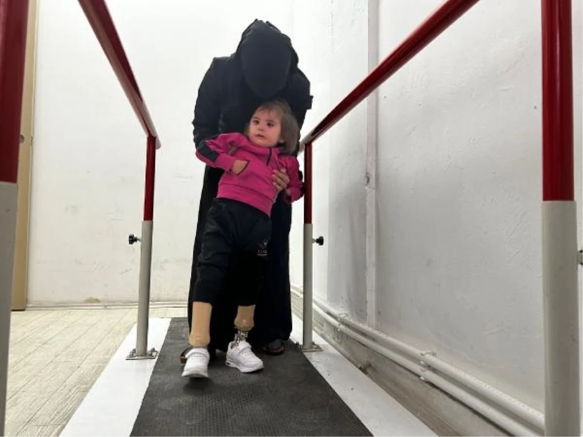Suriyeli çocuğa protez bacaklar takıldı