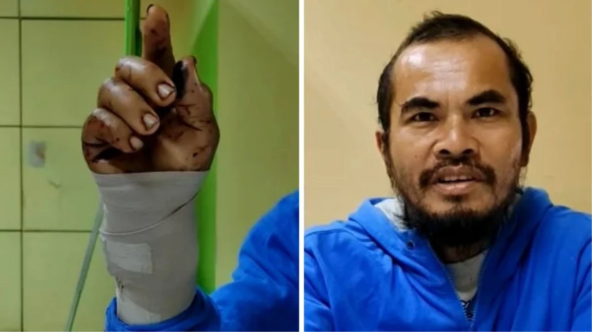 Filipinler\'de bir adam, kendisine saldıran pitonu ısırarak öldürdü