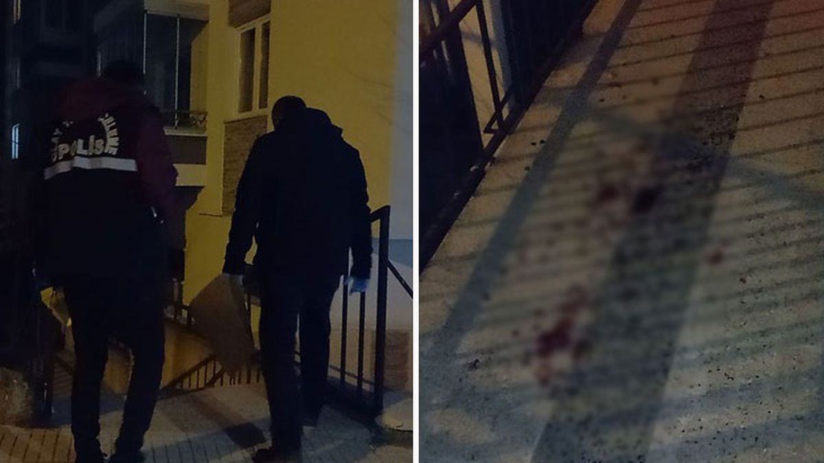 Ağabey ve kardeşin arasında çıkan kavgada kan aktı