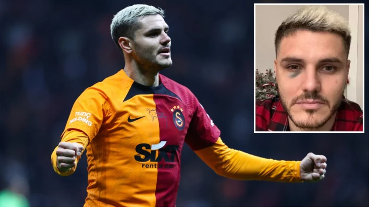 Galatasaray\'da Mauro Icardi depremi! Bir süre yeşil sahalardan uzak kalacak