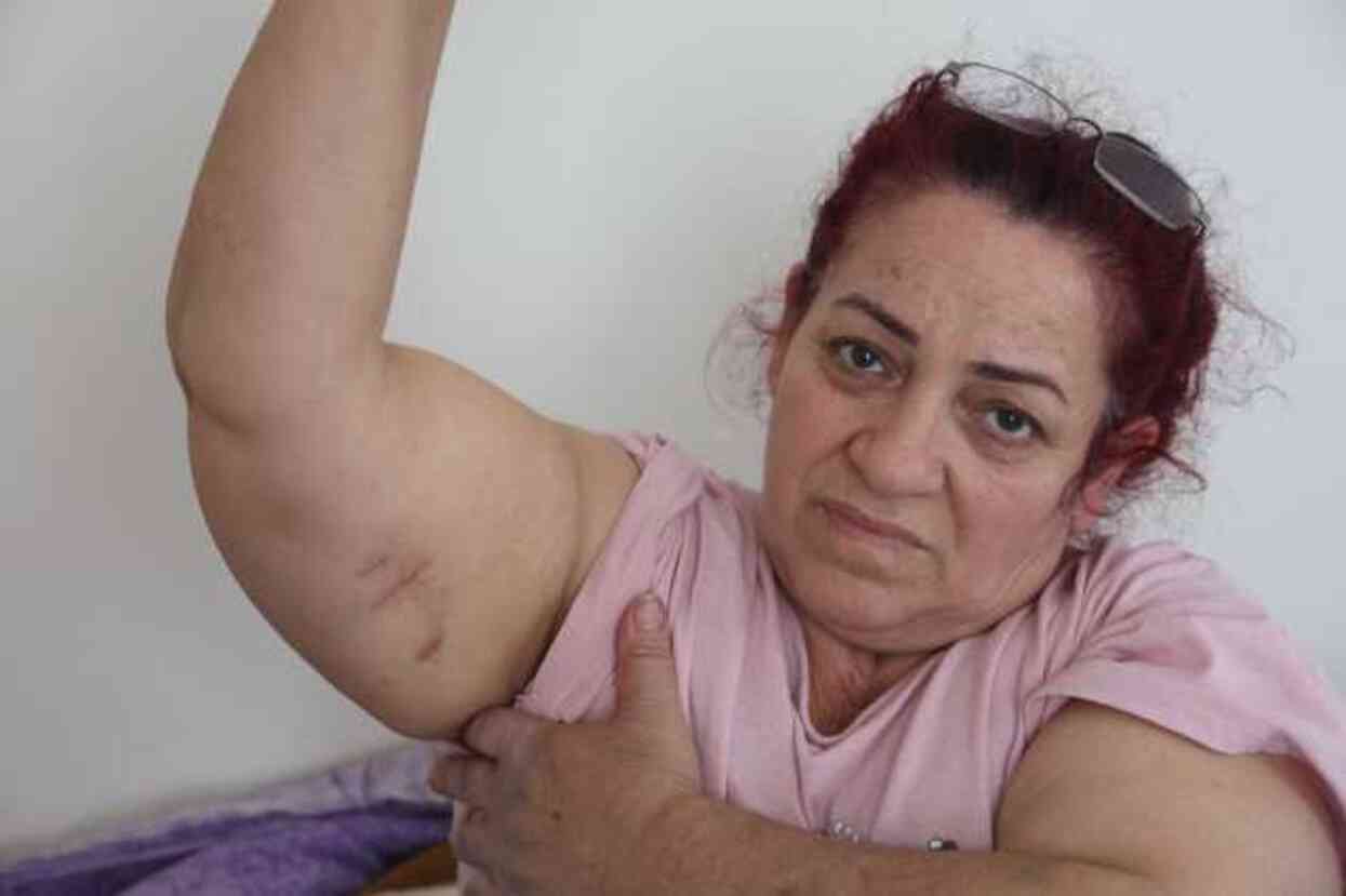 Köpeklerin saldırısına uğrayan kadın: Ben o an öldüğümü sandım Köpeklerin saldırısına uğrayan kadın: Ben o an öldüğümü sandım