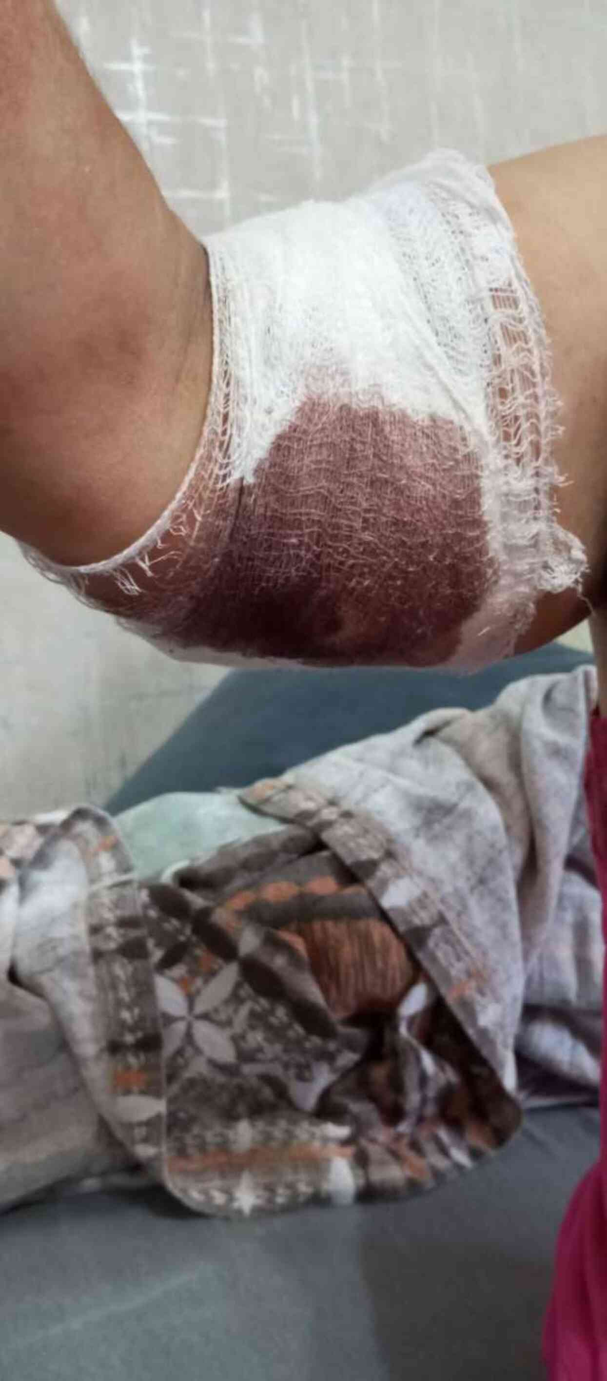 Köpeklerin saldırısına uğrayan kadın: Ben o an öldüğümü sandım Köpeklerin saldırısına uğrayan kadın: Ben o an öldüğümü sandım