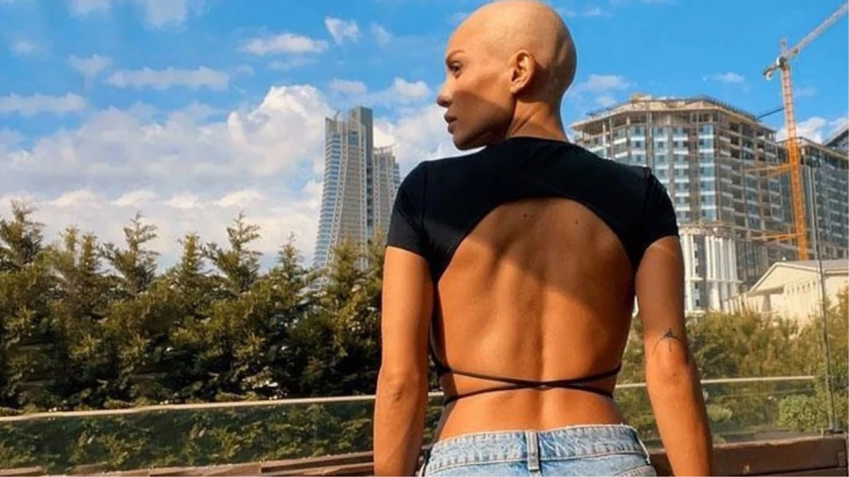 Meme kanserini yenen şarkıcı Şimal\'ın beyninde tümor tespit edildi