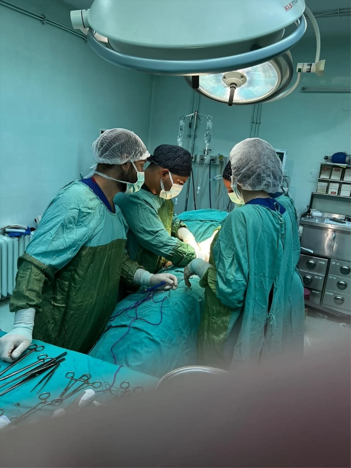 Gaziantep\'te ileri derece obez hastanın kanserli böbreği ameliyatla alındı