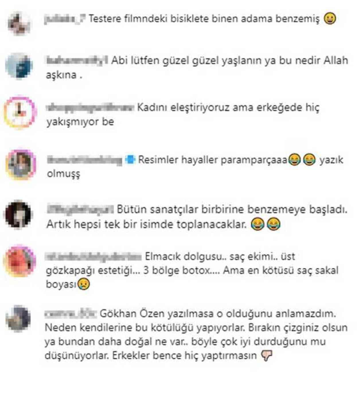 Estetik yaptıran Gökhan Özen, yeni imajıyla hiç beğenilmedi