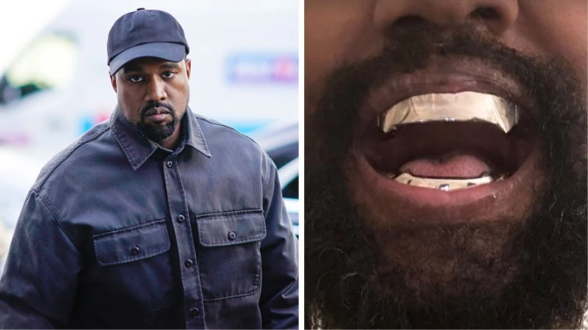 Kanye West, 850 bin dolarlık titanyum protez dişler taktırdı