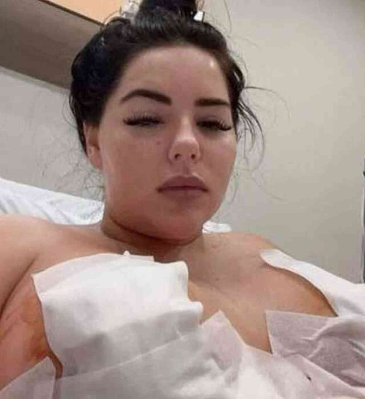 Göğüs dikleştirme operasyonu geçiren İngiliz modelin göğüs uçları çürüdü Göğüs dikleştirme operasyonu geçiren İngiliz modelin göğüs uçları çürüdü
