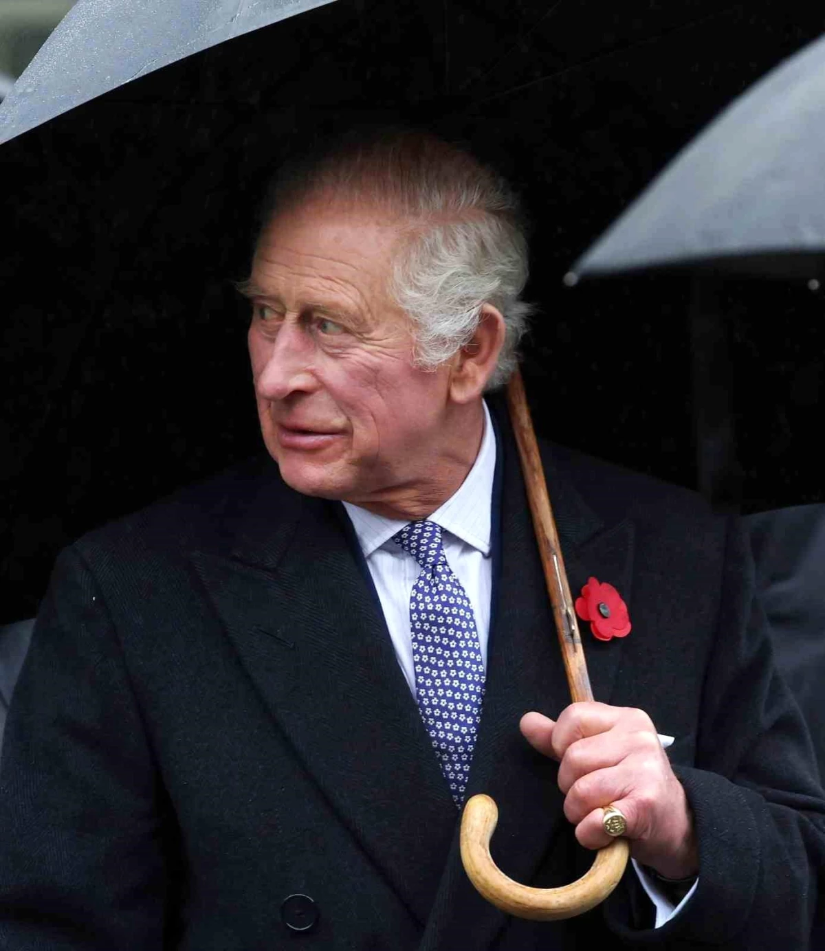 İngiltere Kralı III. Charles, prostat büyümesi nedeniyle hastaneye gitti