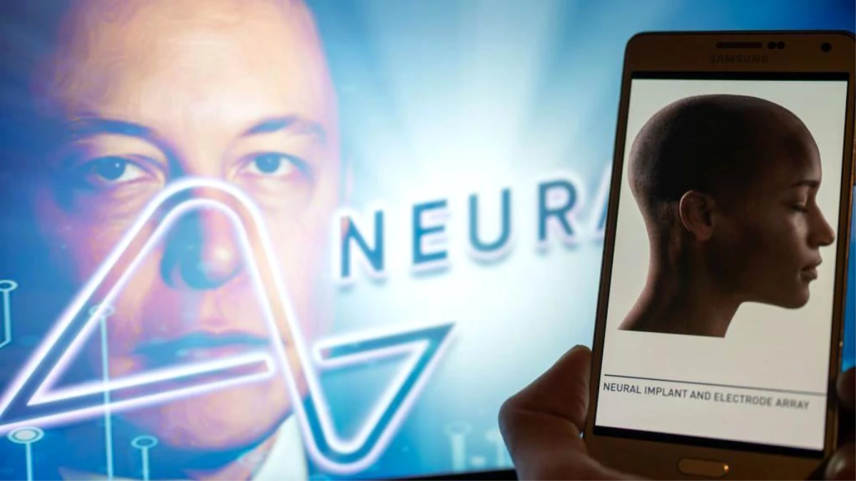Elon Musk, Neuralink ile insan beynine kablosuz çip yerleştirildiğini duyurdu