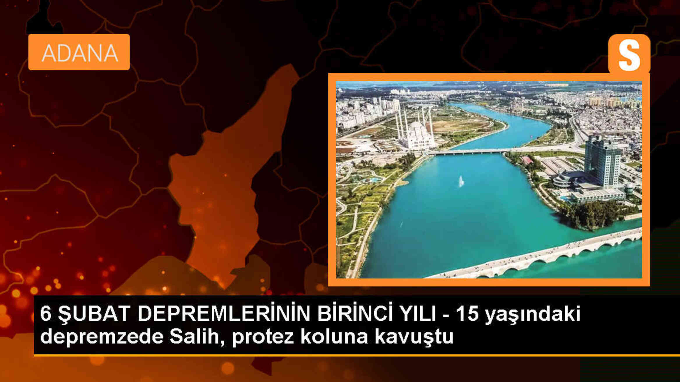 Depremde sağ kolu ampute olan çocuk protezine kavuştu