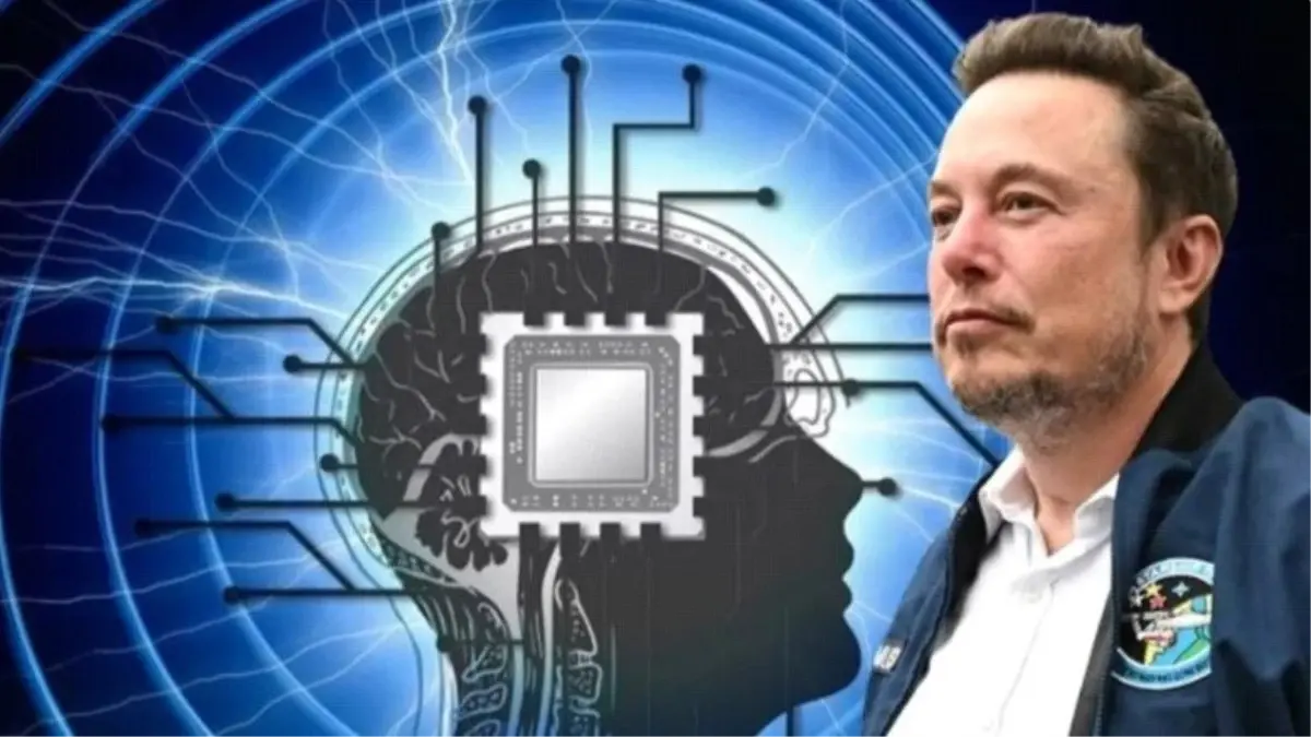 Elon Musk\'ın Neuralink Şirketi İlk Beyin Çipi İmplantını Gerçekleştirdi