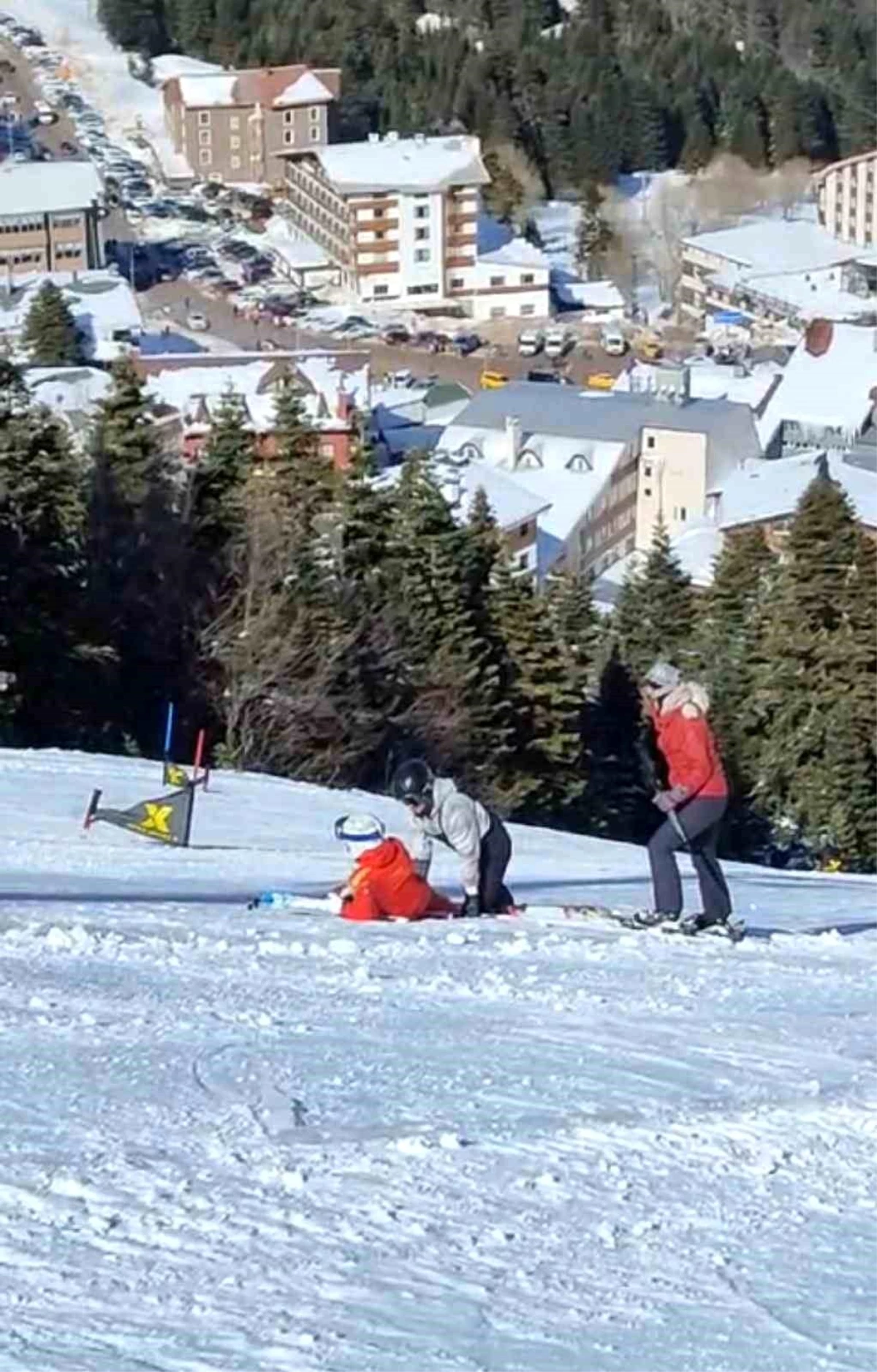 Uludağ\'da Telesiyej Kazası: Kayakçıya Çarpan Baton, İşçiye Ölüm Tehlikesi