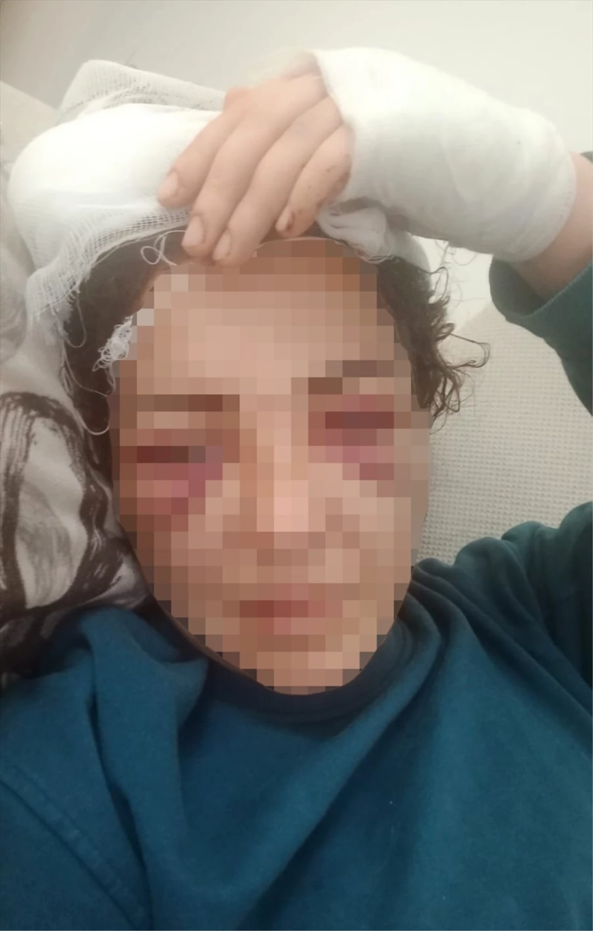 Elektronik kelepçe takılı olan kadın, kocasının bıçaklı saldırısına uğradı