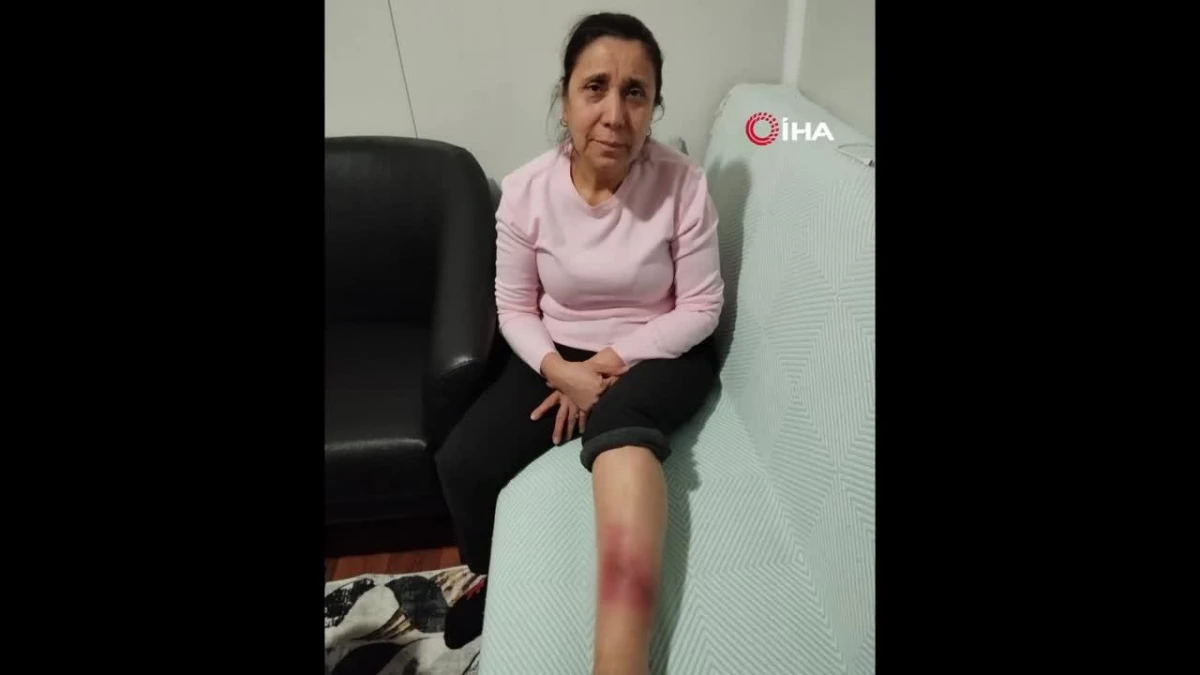 Köpek saldırısına uğrayan kadının bacağında yarık oluştu