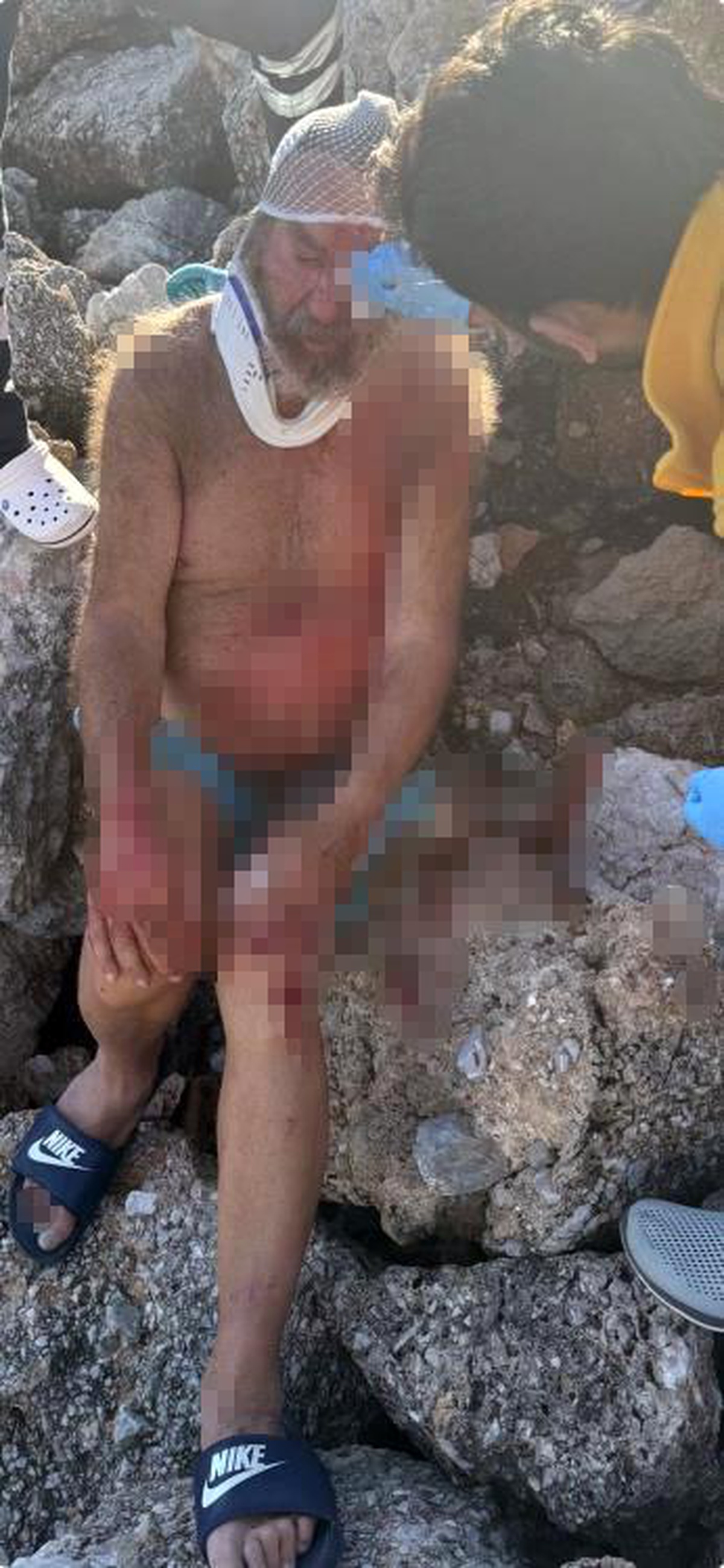Muğla\'nın Datça ilçesinde Alman turist kayalıklardan düşerek yaralandı