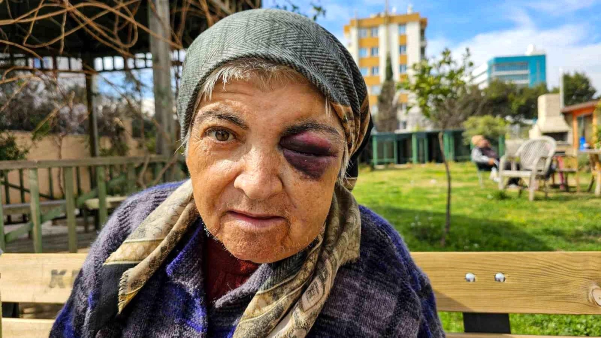 Antalya\'da Zihinsel Engelli Kadın Diyaliz Merkezinde Yaralandı