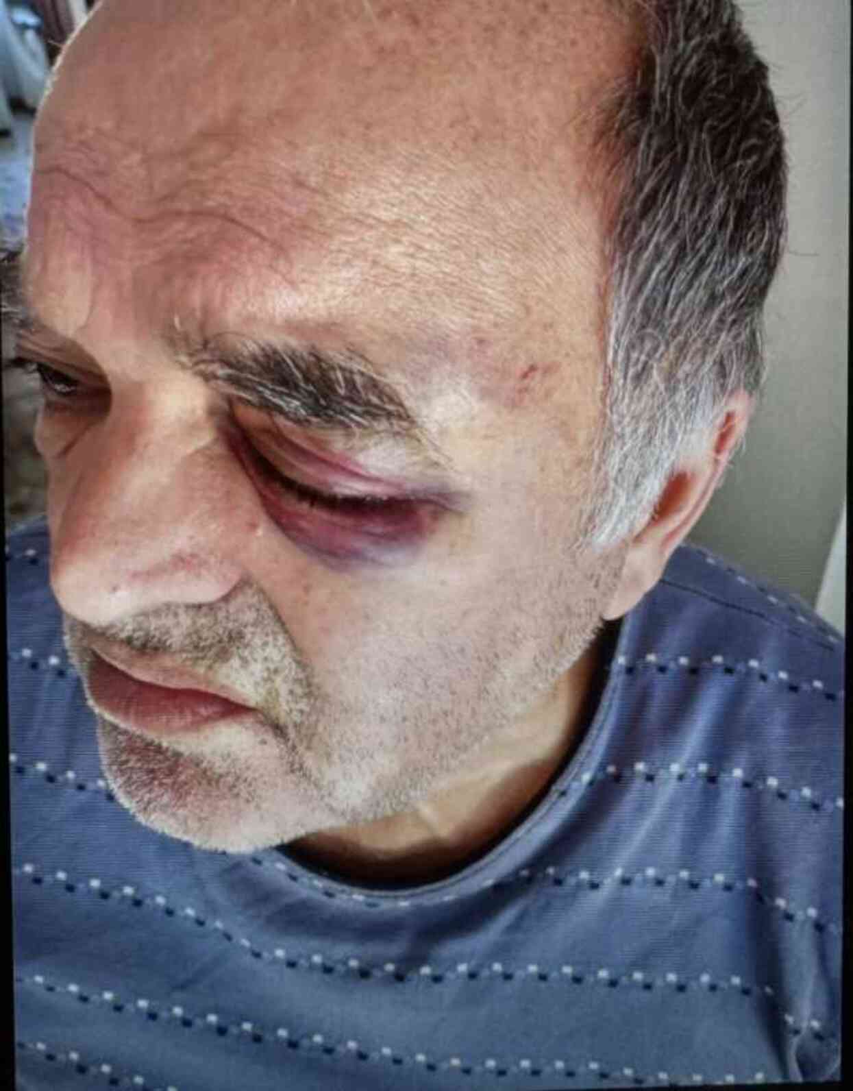 Okul Müdürünün Darp Ettiği Çift İHA'ya Konuştu
