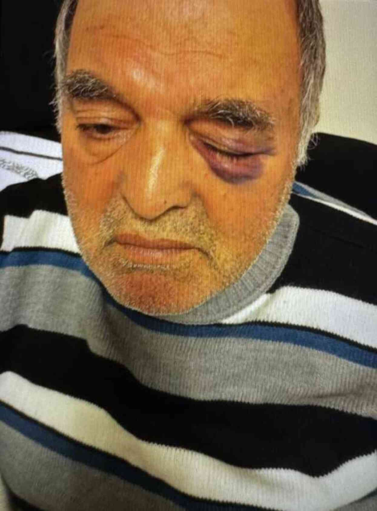Okul Müdürünün Darp Ettiği Çift İHA'ya Konuştu