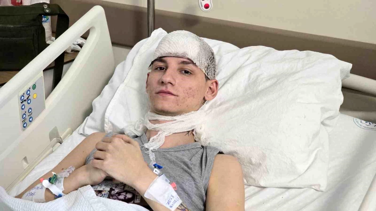 Tokat\'ta Otel Yangınında Ağır Yaralanan Genç, Ölüm Haberlerini Gülerek Anlattı