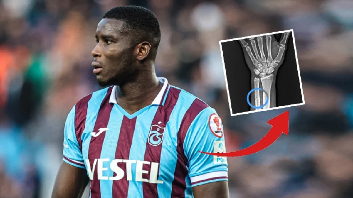 Trabzonspor Onuachu\'da kırık tespit edildiğini açıkladı: VAR\'da göremediğiniz pozisyonun röntgen görüntüsü