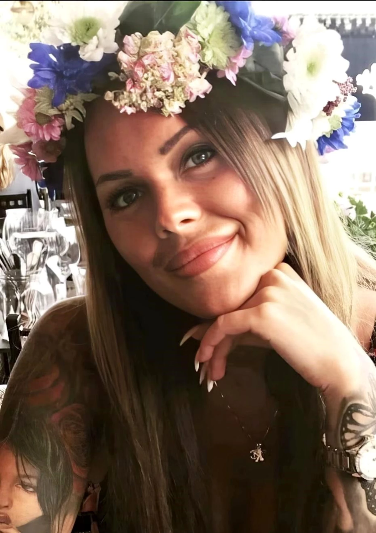 İsveçli kadının İstanbul\'da estetik ameliyat sonrası ölümüne ilişkin ailesi şikayetçi oldu