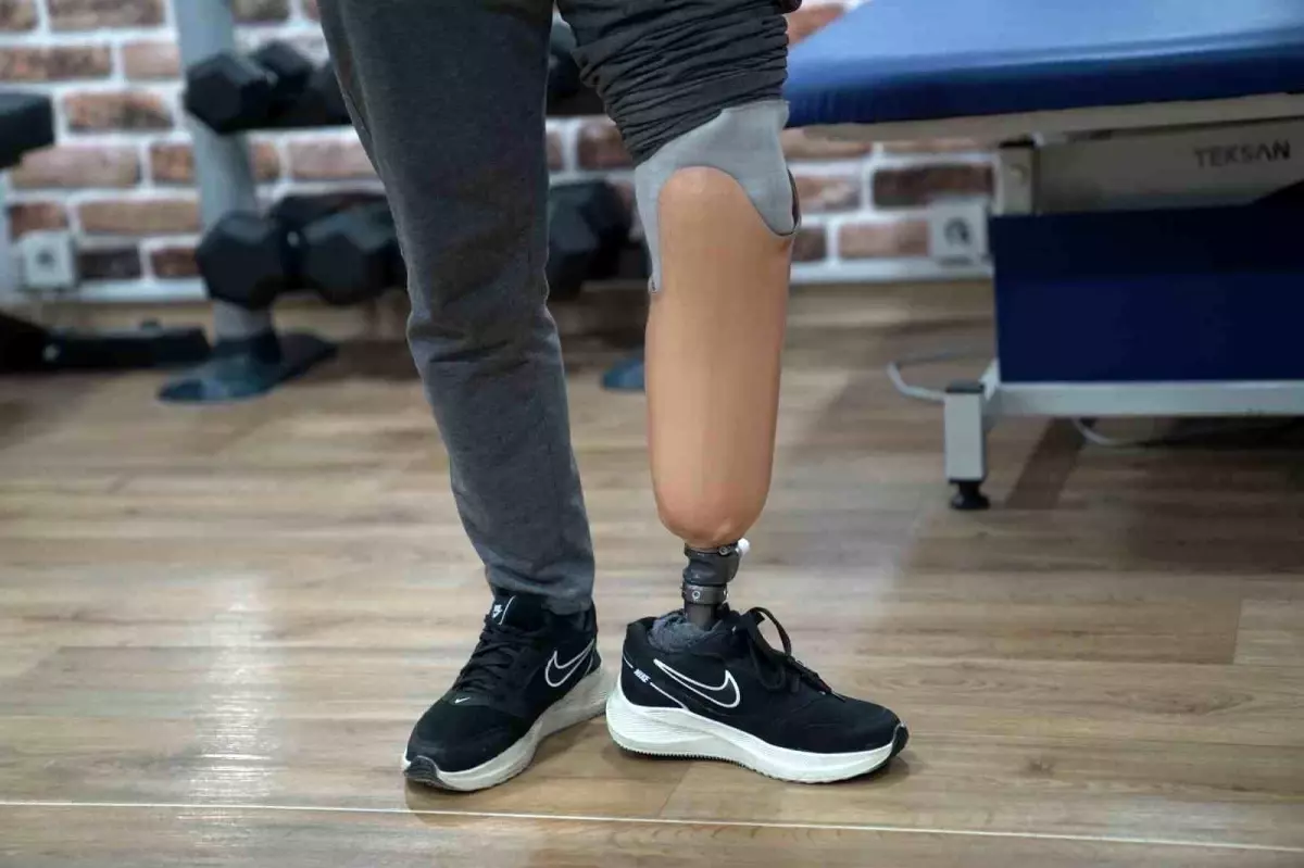 Kahramanmaraş Felaketinde Bacak Kaybeden Murat Akkoç, Yeni Proteziyle Yürüyebiliyor