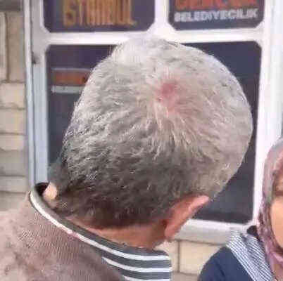 Maltepe'de broşür dağıtan AK Partiliyi darp eden 6 kişi gözaltına alındı Maltepe'de broşür dağıtan AK Partiliyi darp eden 6 kişi gözaltına alındı