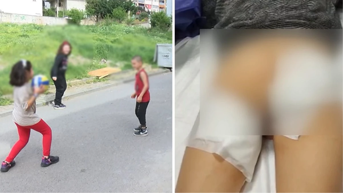 İstanbul\'da 7 yaşındaki çocuğa sokak köpekleri saldırdı, talihsiz çocuğa 30 dikiş atıldı