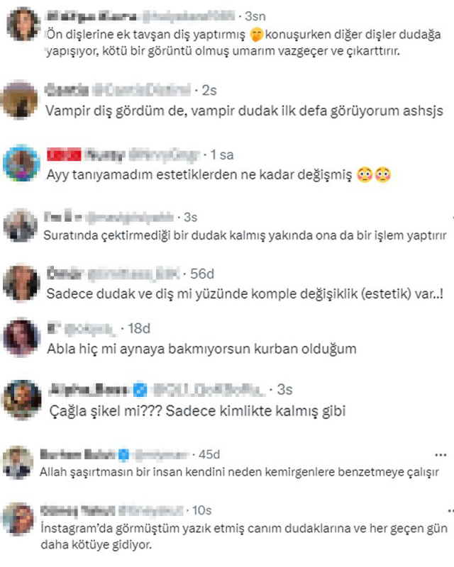 Estetiğin dozunu kaçıran Çağla Şıkel'ın son hali alay konusu oldu