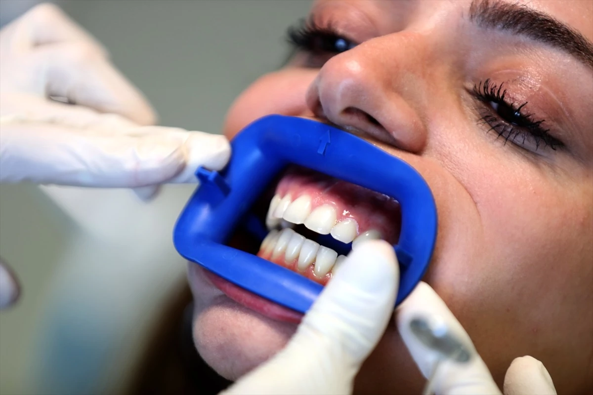 İnternetten alınan diş beyazlatma kitleri diş sağlığını olumsuz etkileyebilir