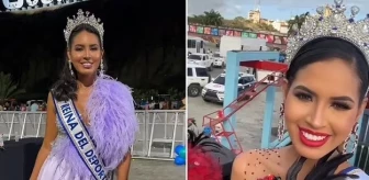 Venezuela güzellik kraliçesi geçirdiği ameliyat sonrası hayatını kaybetti