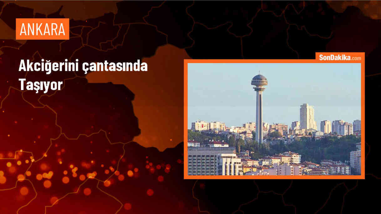Yapay Akciğer Cihazıyla Yaşayan Hastanın Mücadelesi
